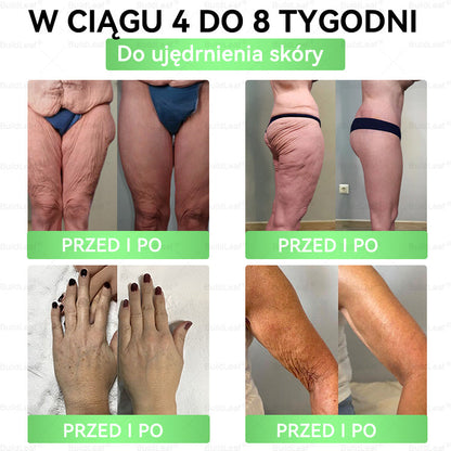 Gratulacje! Odblokowałeś ekskluzywną ofertę BuildLeaf®! Jako podziękowanie za Twoje zamówienie, oferujemy dodatkowe 30% zniżki dzisiaj! Kliknij poniżej, aby skorzystać z tej specjalnej oferty, oferta wygasa!